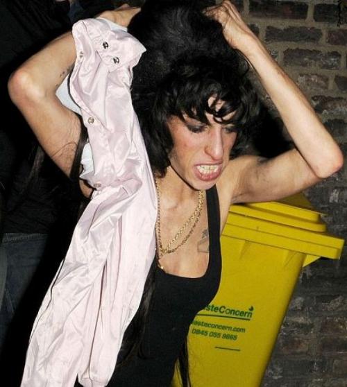 Фотографии звезд, ставшие шоком для их фанатов