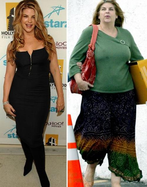 Фотографии звезд, ставшие шоком для их фанатов