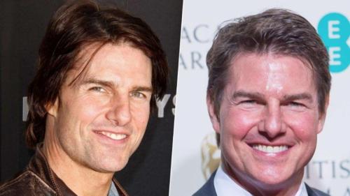 Фотографии звезд, ставшие шоком для их фанатов