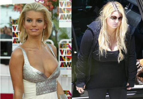 Фотографии звезд, ставшие шоком для их фанатов