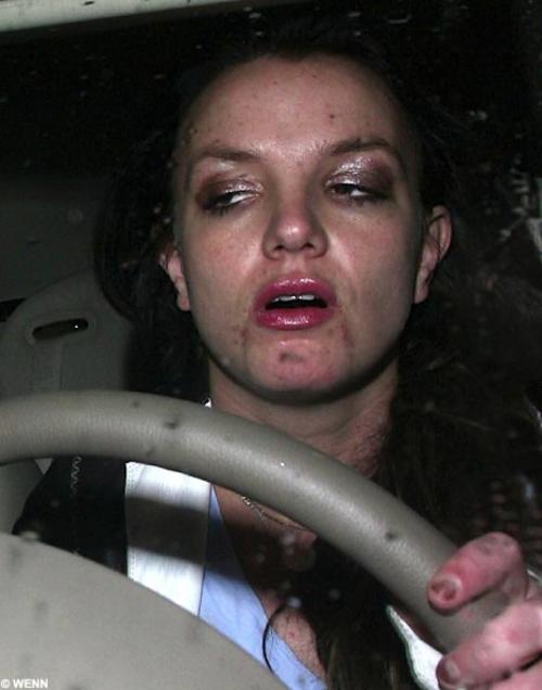 Фотографии звезд, ставшие шоком для их фанатов