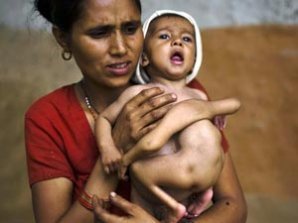 Четырёхрукому ребёнку из Непала поклоняются как богу