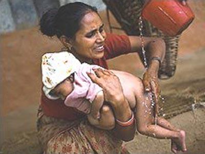 Четырёхрукому ребёнку из Непала поклоняются как богу