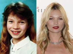 Звезды, которые из «гадких утят» превратились в красавиц