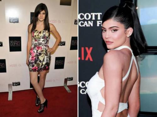 Как изменились знаменитости за последние 10 лет