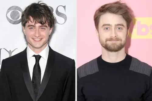 Как изменились знаменитости за последние 10 лет