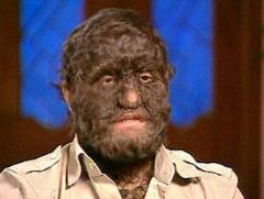 Генетические мутанты: люди-волки, люди-львы, люди-собаки…