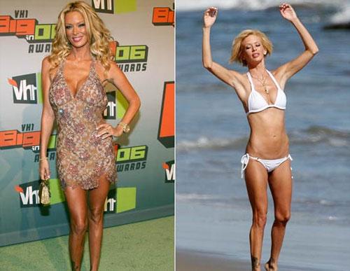 Звездные  эксперименты с телом