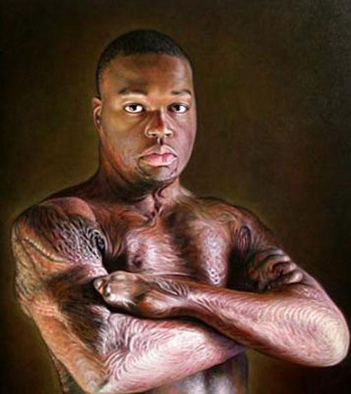 Портреты обожженных людей