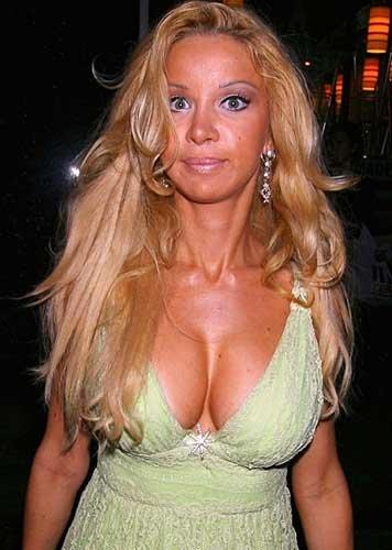 Звезды, попавшие в сети пластического хирурга