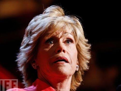 Звезды, попавшие в сети пластического хирурга