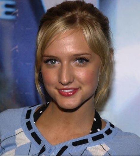 Звезды, попавшие в сети пластического хирурга