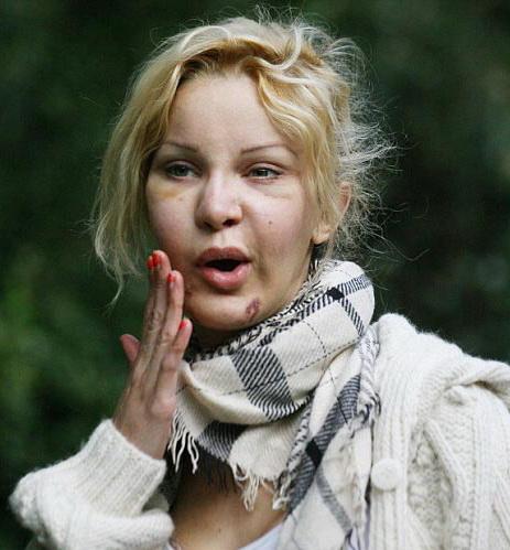 Звезды, попавшие в сети пластического хирурга