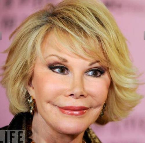 Звезды, попавшие в сети пластического хирурга