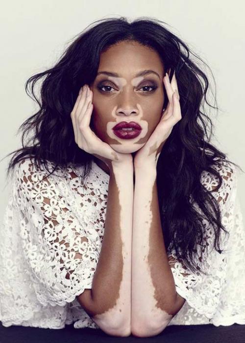 Знаменитые модели со странной внешностью