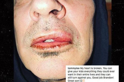 Скандальные выходки знаменитостей, о которых они сожалеют