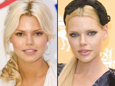 Губы: искусственные прелести знаменитостей