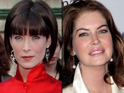 Губы: искусственные прелести знаменитостей