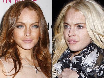 Губы: искусственные прелести знаменитостей