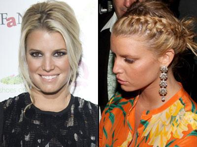 Губы: искусственные прелести знаменитостей