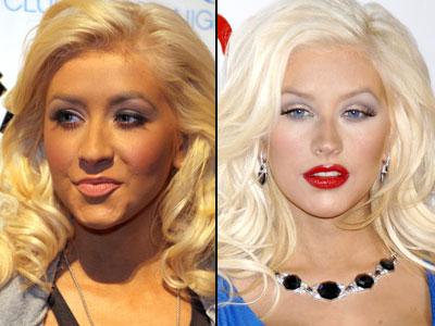 Губы: искусственные прелести знаменитостей