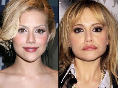 Губы: искусственные прелести знаменитостей