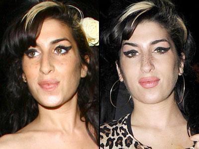 Губы: искусственные прелести знаменитостей