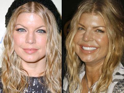 Губы: искусственные прелести знаменитостей