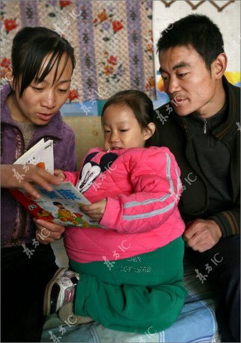 В Китае найдена 4-летняя "беременная" девочка