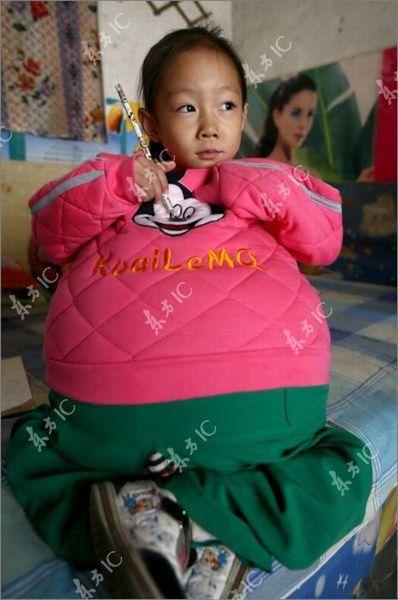 В Китае найдена 4-летняя "беременная" девочка