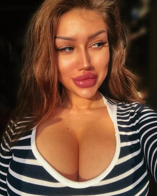 Российская «Кардашьян» отрицает, что обращалась к хирургам