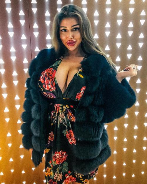 Российская «Кардашьян» отрицает, что обращалась к хирургам