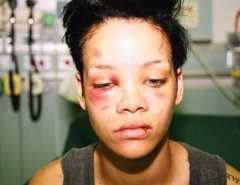 Знаменитости, подвергшиеся домашнему насилию