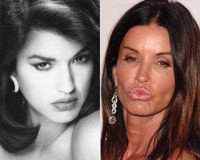 Супермодели в детстве и юности