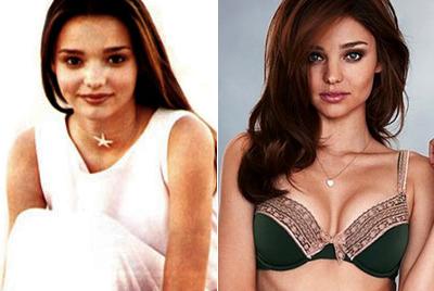 Супермодели в детстве и юности