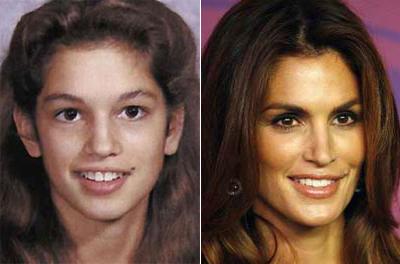 Супермодели в детстве и юности