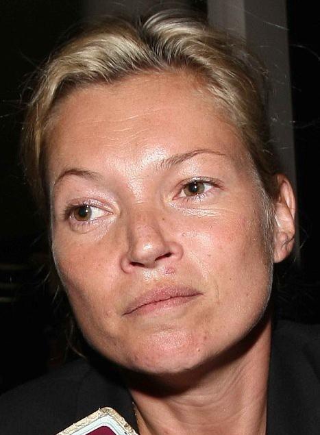 Звезды до и после появления наркотиков и алкоголя в их жизни