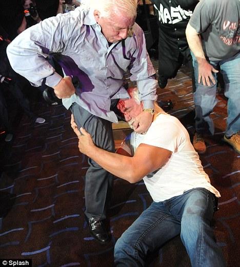 Халку Хогану  разбили лицо на пресс-конференции