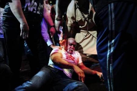 Халку Хогану  разбили лицо на пресс-конференции