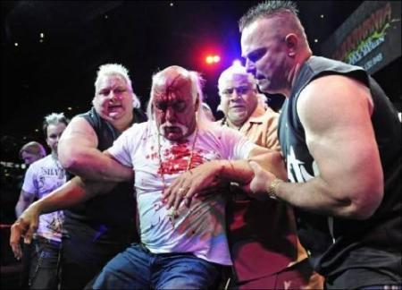 Халку Хогану  разбили лицо на пресс-конференции