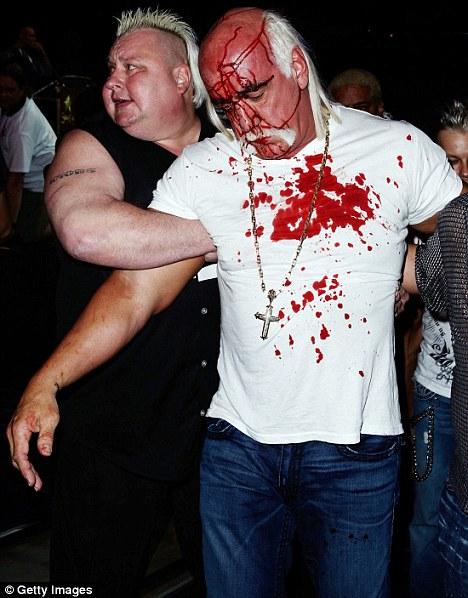 Халку Хогану  разбили лицо на пресс-конференции