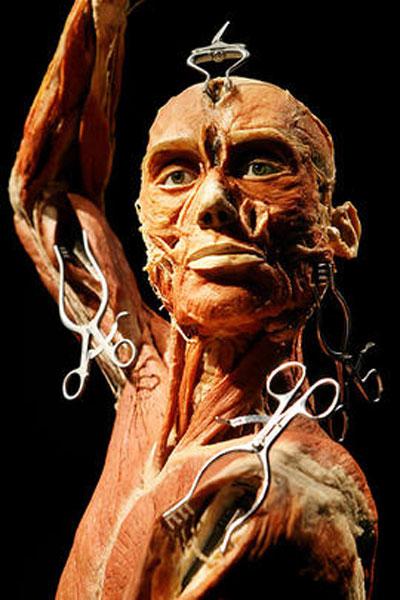 Пластинатор Гюнтер фон Хагенс преподнёс «рождественский  сюрприз»