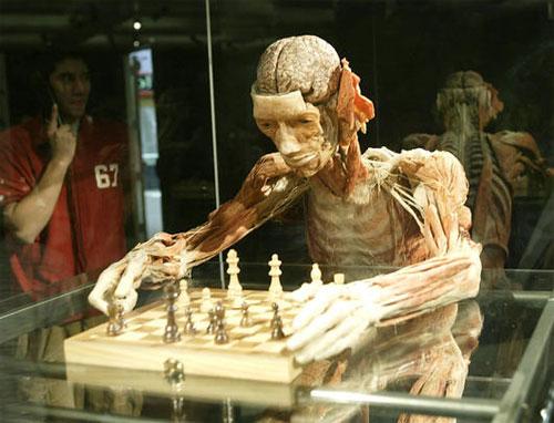 Пластинатор Гюнтер фон Хагенс преподнёс «рождественский  сюрприз»