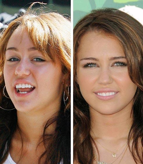 Звезды без макияжа: новая порция компромитрирующих фото