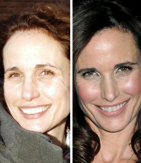 Звезды без макияжа: новая порция компромитрирующих фото