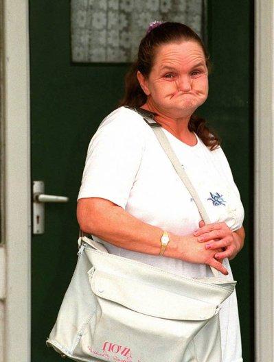 32 года самая страшная женщина мира ждала признания