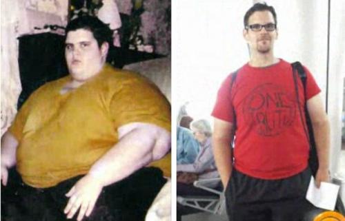 Самые невероятные истории похудения