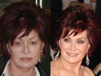 Что скрывают звезды под слоем макияжа