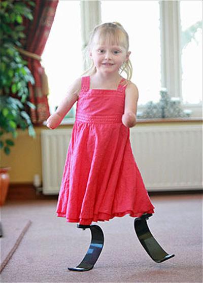 Элли и Оскар выиграли забег без ног