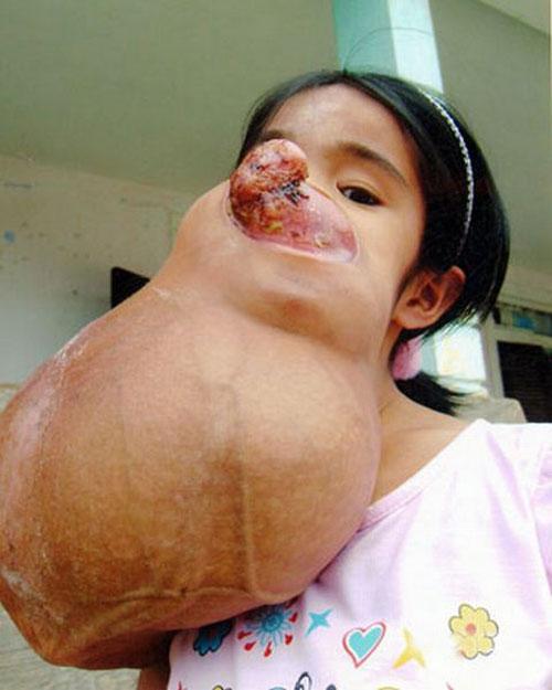 Аномальные дети чаще всего рождаются в Азии